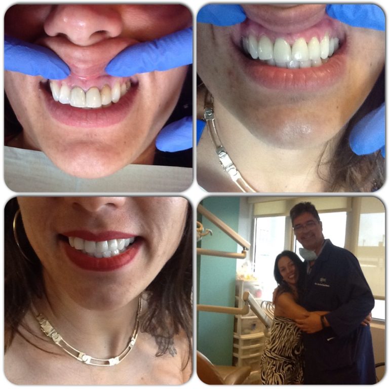 Dental Implants, Cosmetic Dentistry Center Puerto Rico Health